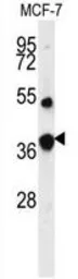 Anti-FBP1 antibody, Internal used in Western Blot (WB). GTX81482