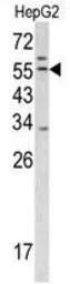 Anti-TMPRSS2 antibody, Internal used in Western Blot (WB). GTX81494