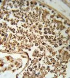 Anti-HSP47 antibody, C-term used in IHC (Paraffin sections) (IHC-P). GTX81503
