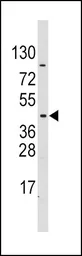 Anti-PDK4 antibody used in Western Blot (WB). GTX81597
