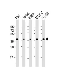 Anti-CD62L antibody, C-term used in Western Blot (WB). GTX81602