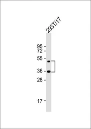 Anti-LAG3 antibody, Internal used in Western Blot (WB). GTX81605