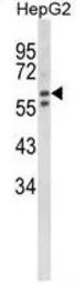 Anti-HEXA antibody, N-term used in Western Blot (WB). GTX81638