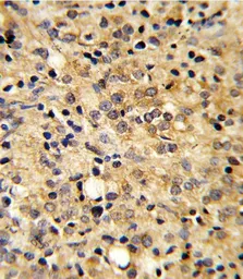 Anti-COMP antibody, Internal used in IHC (Paraffin sections) (IHC-P). GTX81660