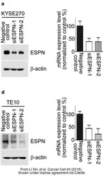 Anti-ESPN antibody, N-term used in Western Blot (WB). GTX81675