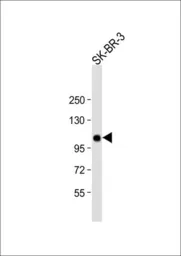 Anti-ESPN antibody, N-term used in Western Blot (WB). GTX81675