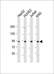 Anti-RAIN antibody, Internal used in Western Blot (WB). GTX81679