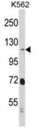 Anti-RAIN antibody, Internal used in Western Blot (WB). GTX81679