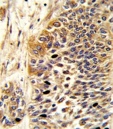 Anti-Wnt4 antibody, Internal used in IHC (Paraffin sections) (IHC-P). GTX81775