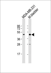 Anti-Wnt4 antibody, Internal used in Western Blot (WB). GTX81775