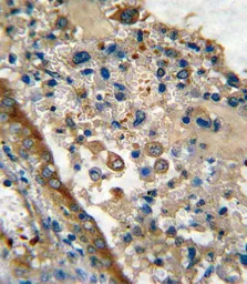 Anti-GARP antibody, Internal used in IHC (Paraffin sections) (IHC-P). GTX81794