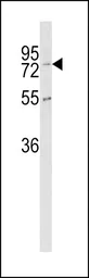 Anti-CPZ antibody, N-term used in Western Blot (WB). GTX81852