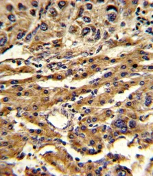 Anti-ABCG1 antibody, Internal used in IHC (Paraffin sections) (IHC-P). GTX81867