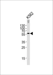 Anti-EPN3 antibody, N-term used in Western Blot (WB). GTX81869