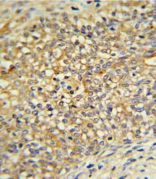 Anti-UGT2B17 antibody, Internal used in IHC (Paraffin sections) (IHC-P). GTX81884