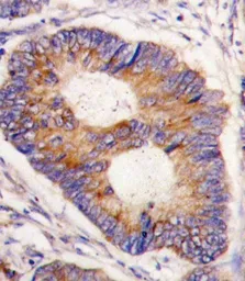 Anti-Frataxin antibody, Internal used in IHC (Paraffin sections) (IHC-P). GTX81888