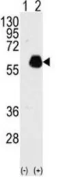 Anti-Paxillin antibody used in Western Blot (WB). GTX81889