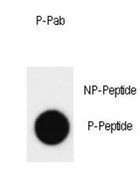 Anti-c-Abl (phospho Tyr412) antibody used in Dot blot (Dot). GTX81938