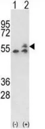 Anti-ATP5B antibody, Internal used in Western Blot (WB). GTX81939