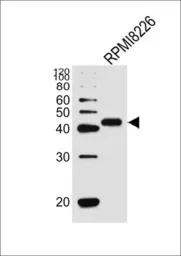 Anti-CD38 antibody, C-term used in Western Blot (WB). GTX81962