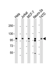 Anti-EZH2 antibody used in Western Blot (WB). GTX82503