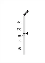 Anti-EZH2 antibody used in Western Blot (WB). GTX82503