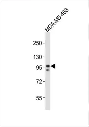 Anti-EZH2 antibody used in Western Blot (WB). GTX82503