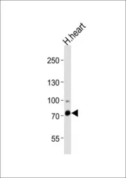 Anti-ZFP219 antibody, N-term used in Western Blot (WB). GTX82519