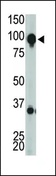 Anti-mGluR8 antibody, C-term used in Western Blot (WB). GTX82530