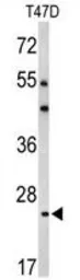 Anti-Bcl2A1 antibody, Internal used in Western Blot (WB). GTX82541