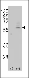 Anti-SLC29A4 antibody, C-term used in Western Blot (WB). GTX82546
