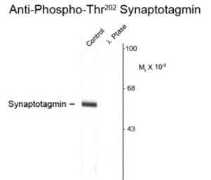 Anti-Synaptotagmin 1 (phospho Thr202) + Synaptotagmin 2 (phospho Thr199) antibody used in Western Blot (WB). GTX82584