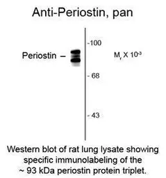 Anti-Periostin antibody used in  (). GTX82615
