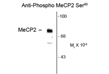 Anti-MECP2 (phospho Ser80) antibody used in Western Blot (WB). GTX82658
