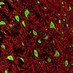 Anti-MAP2 antibody used in Immunohistochemistry (IHC). GTX82661