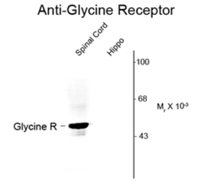 Anti-Glycine Receptor antibody used in Western Blot (WB). GTX82665