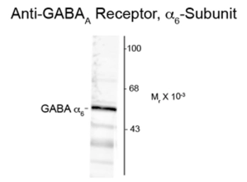 Anti-GABA A Receptor alpha 6 antibody used in Western Blot (WB). GTX82685