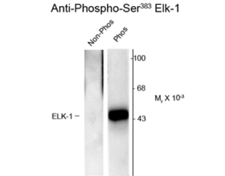 Anti-ELK1 (phospho Ser383) antibody used in Western Blot (WB). GTX82701