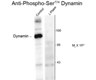 Anti-Dynamin 1 (phospho Ser774) antibody used in Western Blot (WB). GTX82703