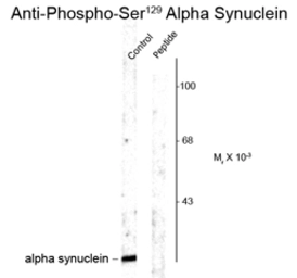 Anti-alpha Synuclein (phospho Ser129) antibody used in Western Blot (WB). GTX82738