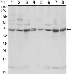 Anti-CSK antibody [5F3] used in Western Blot (WB). GTX82757