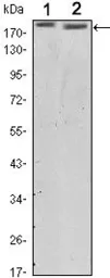 Anti-Her2 / ErbB2 antibody [6C2] used in Western Blot (WB). GTX82764