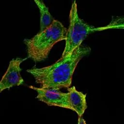 Anti-IKK alpha antibody [3G12H9] used in Immunocytochemistry/ Immunofluorescence (ICC/IF). GTX82770
