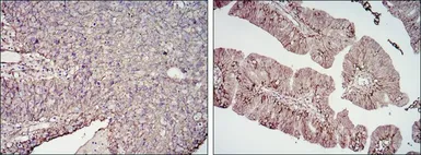 Anti-CD276 antibody [6A1] used in IHC (Paraffin sections) (IHC-P). GTX82773