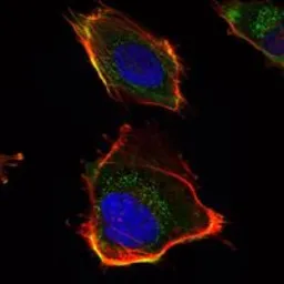 Anti-HAS1 antibody [3E10] used in Immunocytochemistry/ Immunofluorescence (ICC/IF). GTX82799