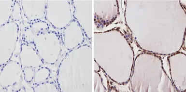 Anti-Thyroid Hormone Receptor alpha-2 antibody used in IHC (Paraffin sections) (IHC-P). GTX82858