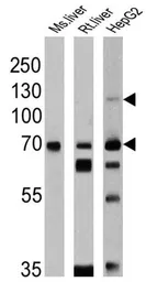 Anti-SREBP2 antibody used in Western Blot (WB). GTX82865