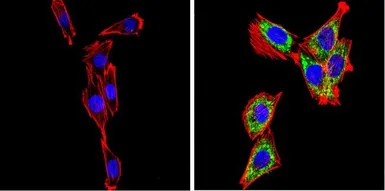 Anti-SREBP2 antibody used in Immunocytochemistry/ Immunofluorescence (ICC/IF). GTX82865