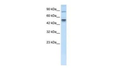 Anti-MDMX / MDM4 antibody, N-term used in Western Blot (WB). GTX82948