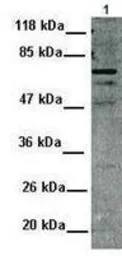 Anti-MDMX / MDM4 antibody, N-term used in Western Blot (WB). GTX82948